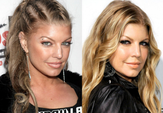 Sredile su nos uz pomoć plastične operacije i to su javno priznale (FOTO)