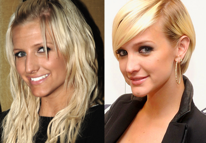 Sredile su nos uz pomoć plastične operacije i to su javno priznale (FOTO)