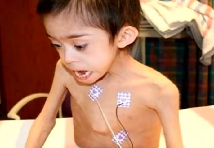 Bili su užasnuti kada su pronašli 6-godišnjeg dječaka sa Downovim sindromom zaključanog u potkrovlju (VIDEO)