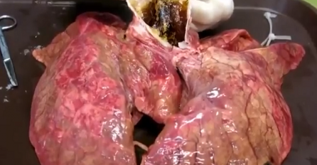 Pogledajte kako izgledaju vaša pluća nakon samo 60 cigareta (VIDEO)