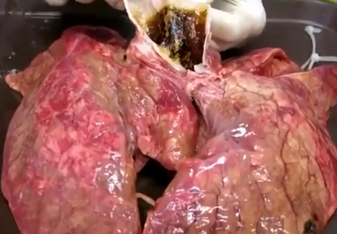Pogledajte kako izgledaju vaša pluća nakon samo 60 cigareta (VIDEO)