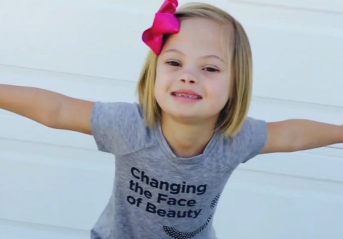 Osvojila sva srca: Djevojčica dokazala da Downov sindrom može biti uzbudljiv i inspirisati hiljade ljudi!