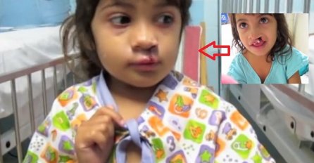  Djevojčica vidi svoj novi osmijeh po prvi put: Njena reakcija će vam rastopiti srce! (VIDEO)