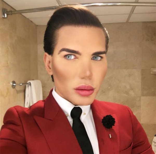 potrosio-je-vise-hiljada-dolara-na-operacije-procenjeno-je-da-je-potrosio-oko-375000-dolara-1