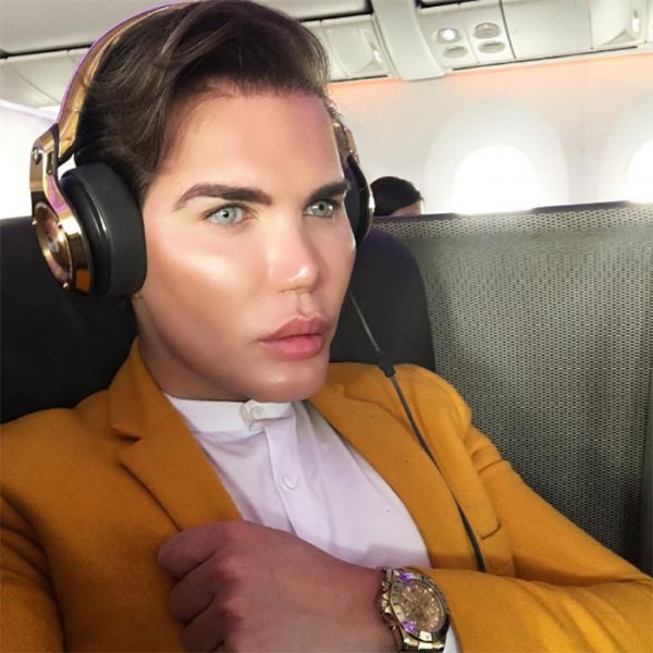 nakon-sedme-operacije-nosa-u-februaru-pojavila-se-nova-rupa-u-nosu-nakon-cega-je-lecen-4