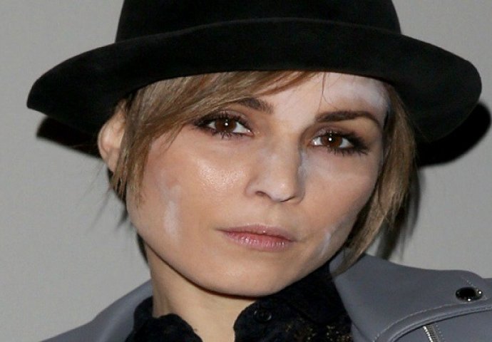 Koji kiks: 8 slavnih dama koje je puder obrukao na crvenom tepihu