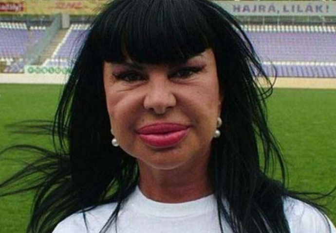 Otišli su pod nož i od sebe napravili rugobe  (FOTO)