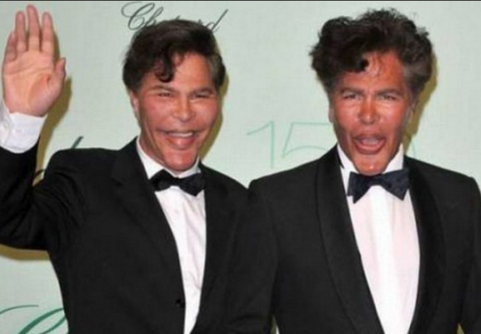 Otišli su pod nož i od sebe napravili rugobe  (FOTO)