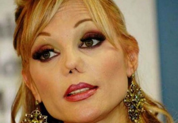 Otišli su pod nož i od sebe napravili rugobe  (FOTO)