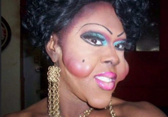 Otišli su pod nož i od sebe napravili rugobe  (FOTO)