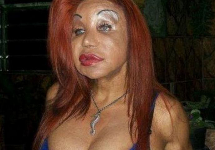 Otišli su pod nož i od sebe napravili rugobe  (FOTO)