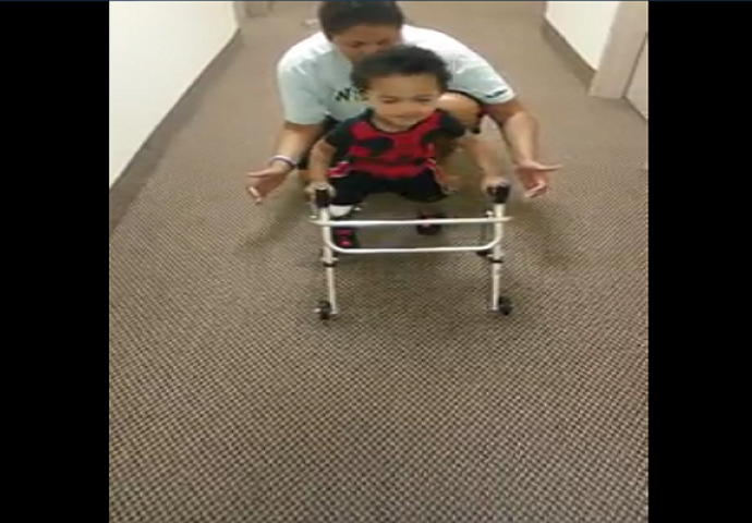Dvogodišnjak naučio hodati na protezama i osvojio internet (VIDEO)