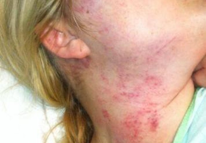 Otac potpuno šokirao javnost kada je objavio  fotografije kćerke koju je dečko zlostavljao!