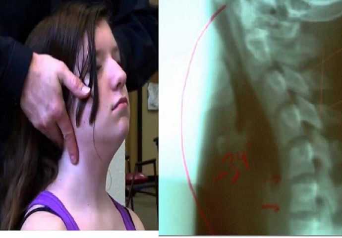 Došla je doktoru sa strašnim bolovima u vratu a onda su se užasnuli šta su otkrili (VIDEO)