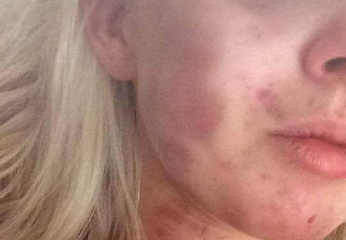  Brutalno je pretukao svoju djevojku, a ono što je nakon toga izjavio šokiralo je i policajce!