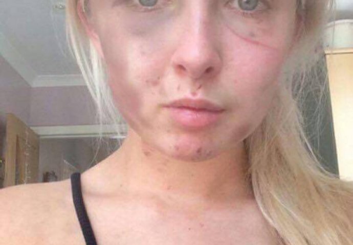  Brutalno je pretukao svoju djevojku, a ono što je nakon toga izjavio šokiralo je i policajce!