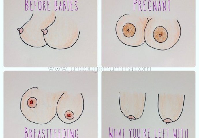 Duhovita ilustracija grudi prije i poslije trudnoće