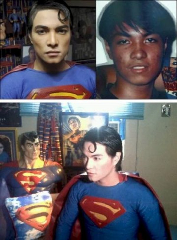 ovaj-supermenov-superfan-16-godina-se-podlagao-operacijama-kako-bi-izgledao-kao-omiljeni-superheroj-1