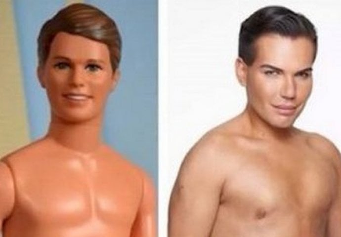 Potrošili su milione kako bi izgledali kao poznate ličnosti, a kad vidite na šta sad liče, neće vam biti dobro!