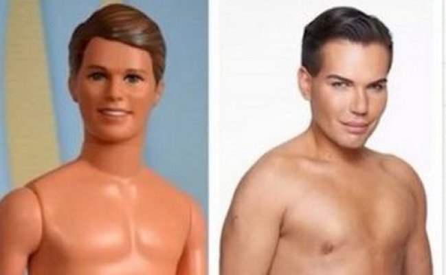 rodrigo-alves-poznat-je-kao-ovisnik-o-plasticnu-hirurgiju-do-sada-je-potrosio-vise-170-000-3-c24