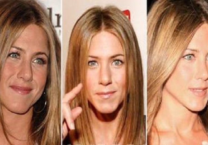  Ove poznate ličnosti prije plastičnih operacija nisu ličile ni na šta, a sada izgledaju fenomenalno 