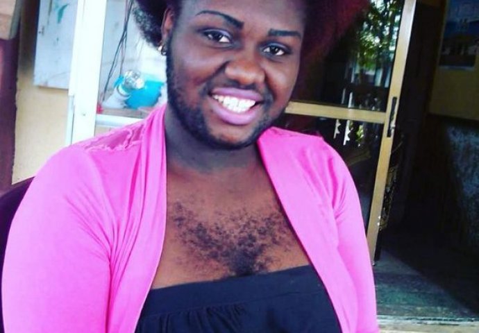 Ona je ponosna na svoje dlakave grudi: "Mogu da me kritikuju, ali privlačna sam muškarcima" (FOTO)