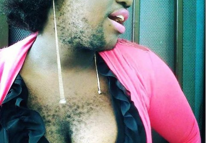 Ona je ponosna na svoje dlakave grudi: "Mogu da me kritikuju, ali privlačna sam muškarcima" (FOTO)