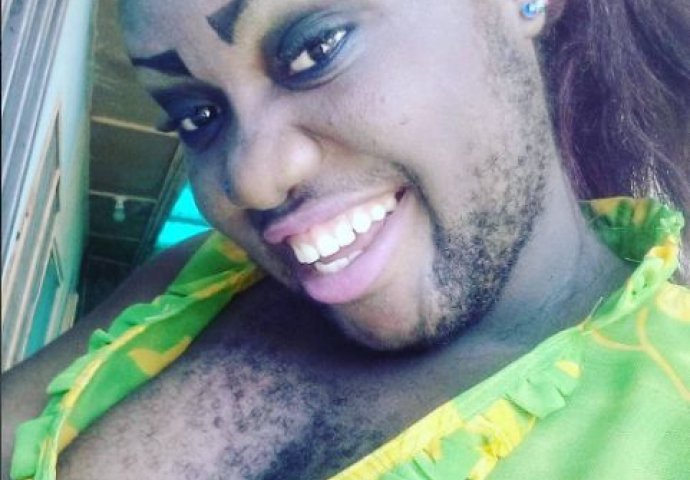 Ona je ponosna na svoje dlakave grudi: "Mogu da me kritikuju, ali privlačna sam muškarcima" (FOTO)