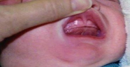 Roditelji zlostavljači: Nakon što su policajci ugledali usta ovog novorođenčeta, odmah su uhapsili roditelje (FOTO)