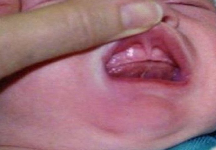 Roditelji zlostavljači: Nakon što su policajci ugledali usta ovog novorođenčeta, odmah su uhapsili roditelje (FOTO)