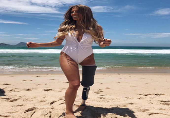 Objavila je fotografiju u bikiniju i pokazala kako je sudbina ne može slomiti, a uz to je postala i inspiracija mnogima (FOTO)