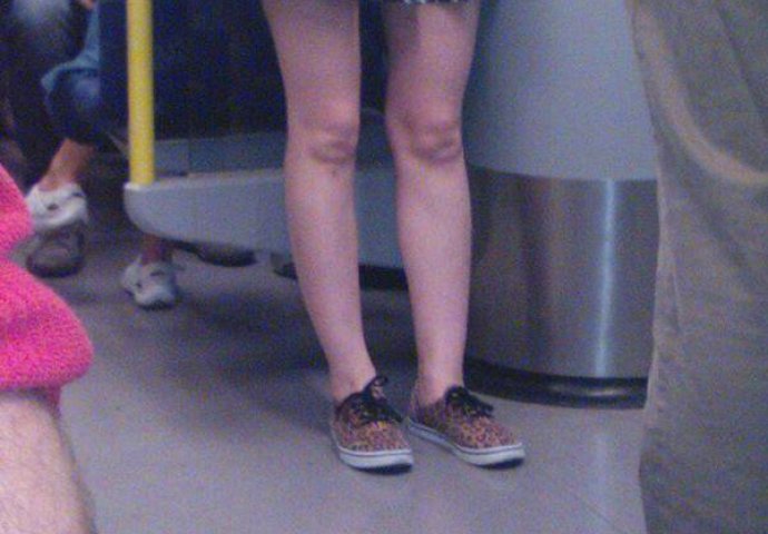 Zgodna djevojka je ušla u autobus, ali kad su pogledali u njena koljena, zaprepastili su se!