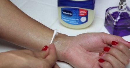 Uzela je malo vazelina i nanijela ga na ruku: Kada vidite razlog, uradit ćete isto (VIDEO)
