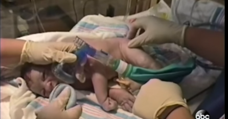 Kada su u salu za porođaje pohrlili doktori, znala je da nešto sa njenom bebom nije u redu, ali ovo nije očekivala (VIDEO)