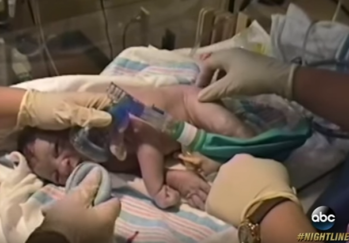 Kada su u salu za porođaje pohrlili doktori, znala je da nešto sa njenom bebom nije u redu, ali ovo nije očekivala (VIDEO)