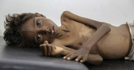 I glad ima svoje lice: Nad ovom djecom se nadvila smrt, a niko ništa ne poduzima da se to spriječi (UZNEMIRUJUĆI FOTO)