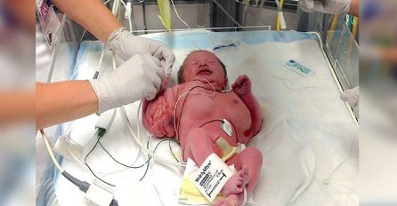Na ultrazvuku su vidjeli da nešto s bebom nije u redu! Majka nije htjela da pobaci i ovako njena djevojčica izgleda danas (VIDEO)