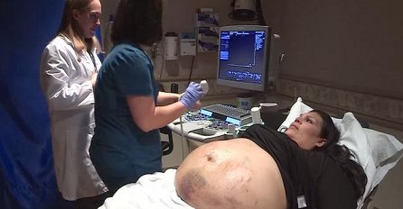 Trudnički stomak ove žene je bio prekriven modricama, ultrazvuk je otkrio zapanjujuću istinu (VIDEO)