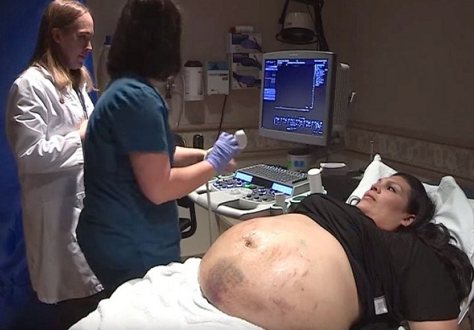 Trudnički stomak ove žene je bio prekriven modricama, ultrazvuk je otkrio zapanjujuću istinu (VIDEO)
