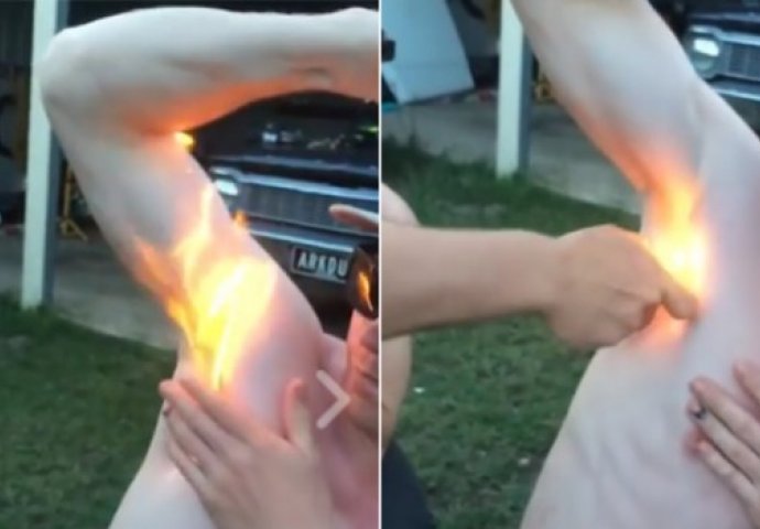 Stavio je dezodorans i upaljačem izazvao vatreni haos: Pazuh mu je gorio, na kraju ništa nije ostalo! (VIDEO)