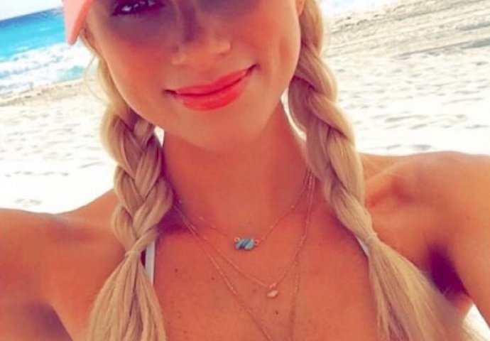 Htjele su se pohvaliti slatkim jamicama na obrazu, ali svi gledaju nešto drugo