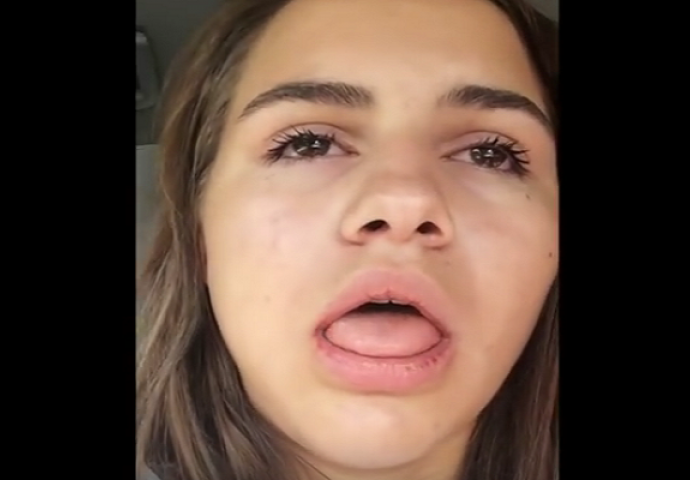Nadrogirana djevojčica postala hit na internetu: Zbog jake anestezije umislila da je vampir (VIDEO)