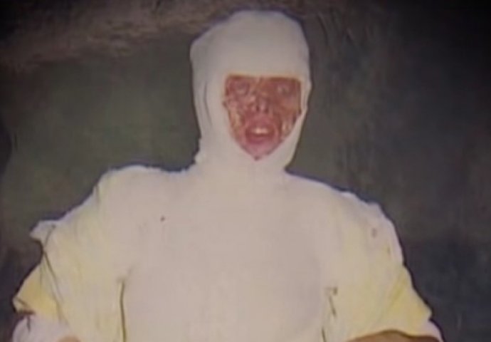 Tinejdžerku su napala 3 muškarca i posuli joj kiselinu na lice: 10 godina kasnije, ona izgleda ovako!