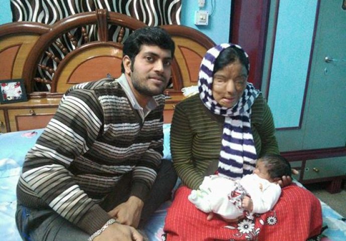 Tinejdžerku su napala 3 muškarca i posuli joj kiselinu na lice: 10 godina kasnije, ona izgleda ovako!