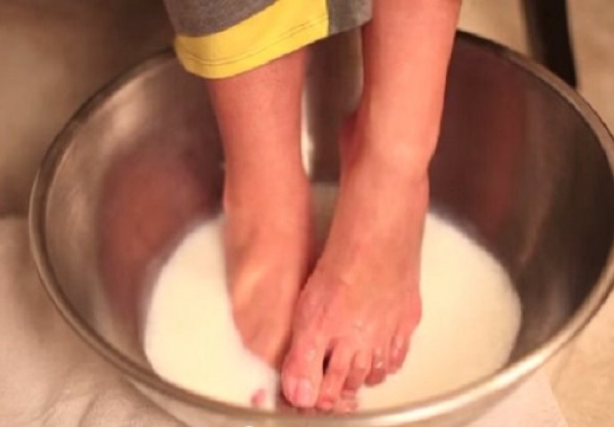 Sipala je sodu bikarbonu u lavor s mlijekom pa zamočila noge, rezultat je čudesan (VIDEO)