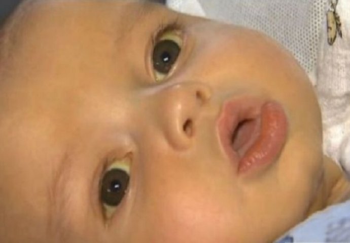 Ljekari su rekli majci da je beba zdrava, ali ono što je spazila u njenom oku je užas (VIDEO)