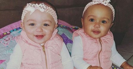 Ove bebe su bliznakinje, jedna ima bijelu, a druga crnu kožu: A tek kad vidite kakve su im oči (FOTO & VIDEO)