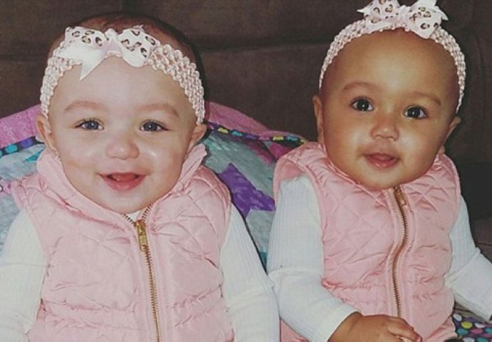 Ove bebe su bliznakinje, jedna ima bijelu, a druga crnu kožu: A tek kad vidite kakve su im oči (FOTO & VIDEO)