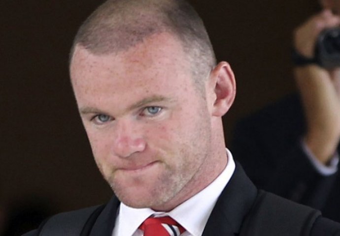 Da nisu presadili kosu ovako bi izgledali: Broj pet će vas posebno iznenaditi