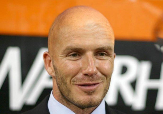 Da nisu presadili kosu ovako bi izgledali: Broj pet će vas posebno iznenaditi